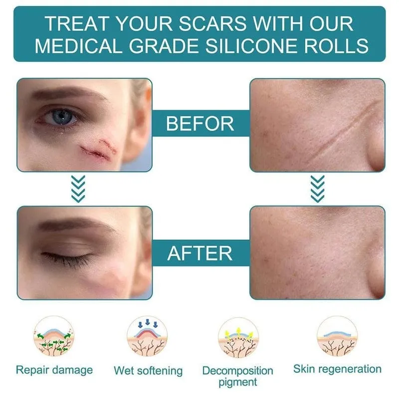 Dermoxy™️ Scar Removal Tape